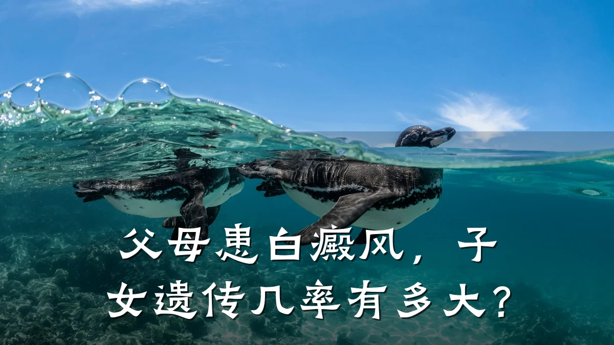 父母患白癜风,子女遗传几率有多大?